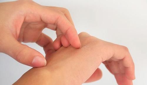 北方人洗澡爱“搓”,搓出来的泥是什么不爱搓澡是不讲卫生吗