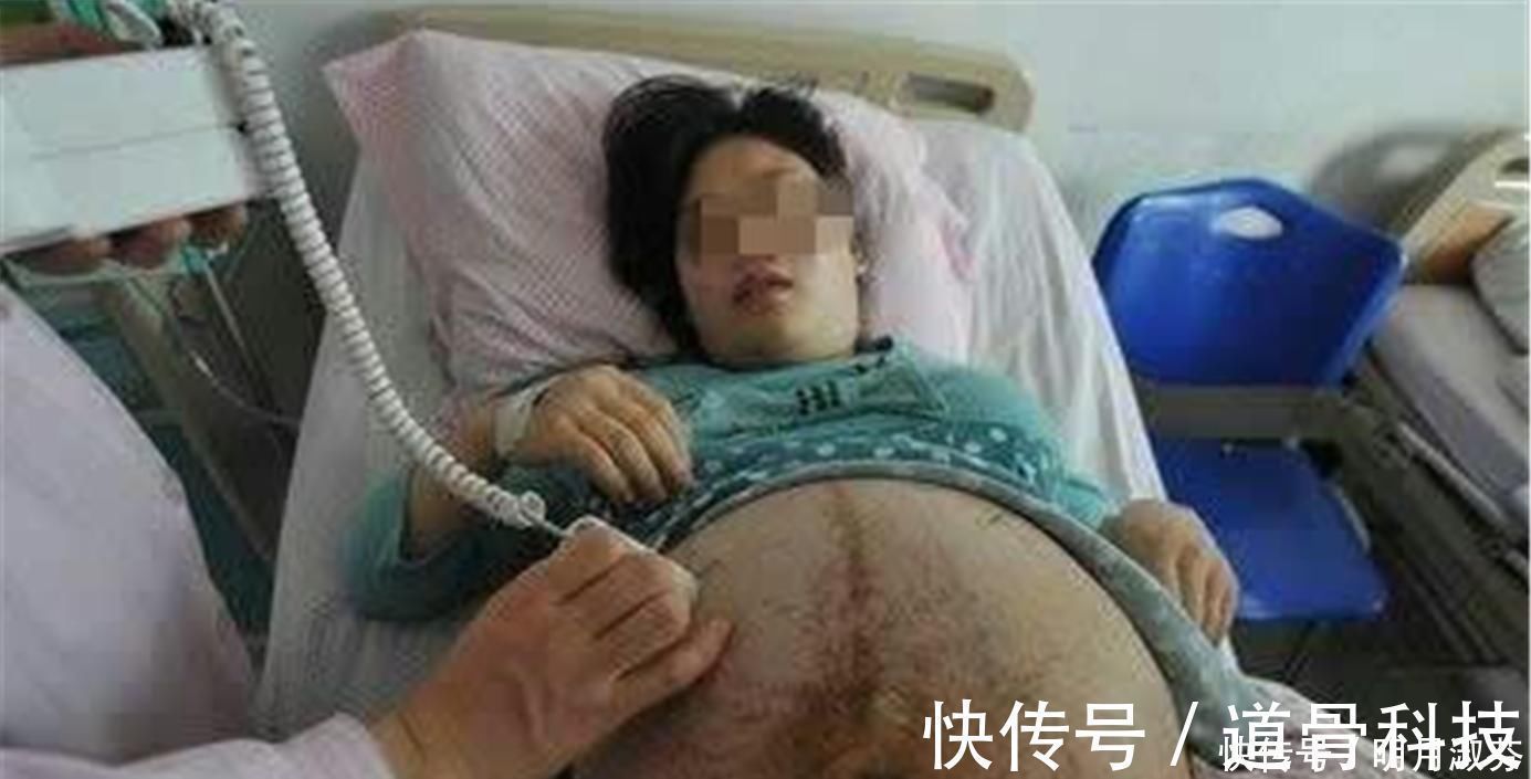 肚子|90后孕妈顺产三胞胎,缝合时大喊“还有一个”,把医生都逗笑了