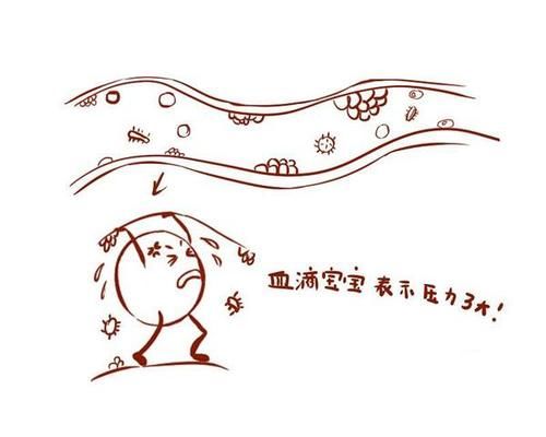 误区|血脂高是心脑血管疾病的元凶，高血脂的6个误区，你了解多少？