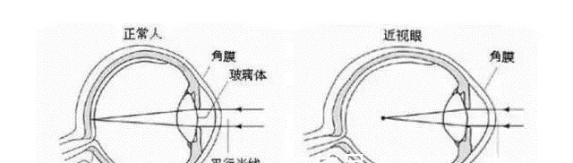 视力|保护孩子视力成长的关键，这3点家长要尽快去做来预防近视