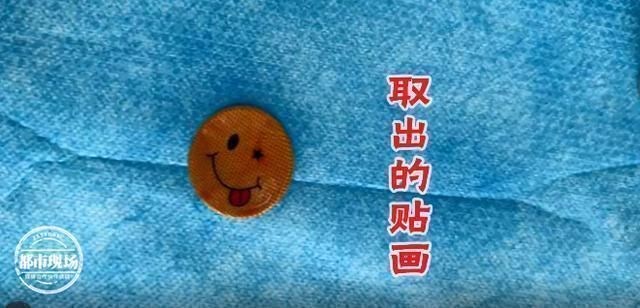 上腭|1岁女童玩玩具,贴在嘴里2个星期取下来时全是血