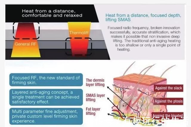 射频 热玛吉、热拉提，到底哪个更适合你！