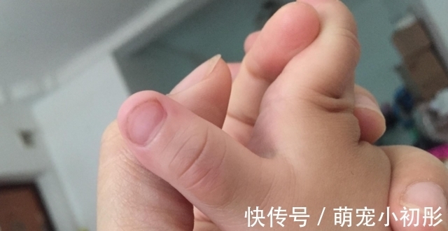 手眼|“啃手”与“不啃手”的宝宝,差别比想象中多,戒掉需注意方法