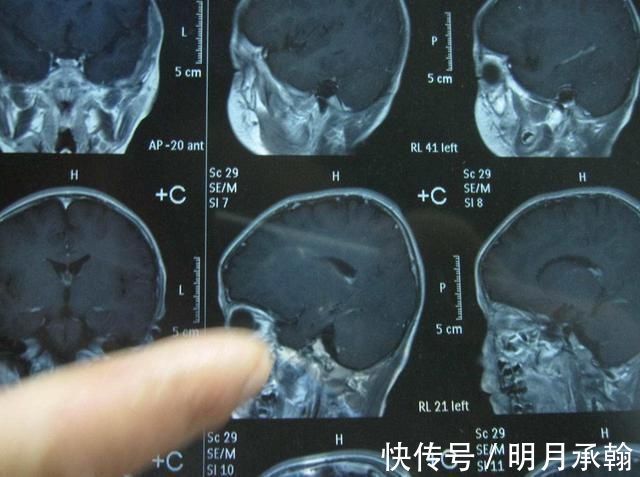 发育|孩子迟迟没长高,是长得晚还是天生矮要看三方面指标