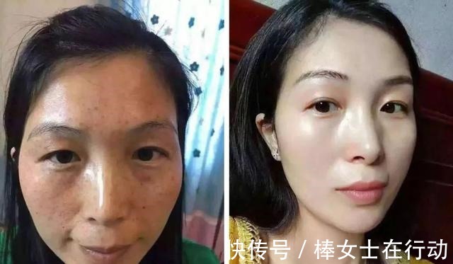 维生素e|维生素E加一物敷脸,不出半个月皮肤紧致嫩滑,色斑也变淡了不少!