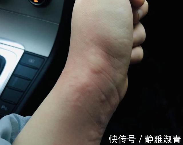 怀孕期间|怀孕后,不仅仅是肚子变大!还有这8种变化,你经历过几种?