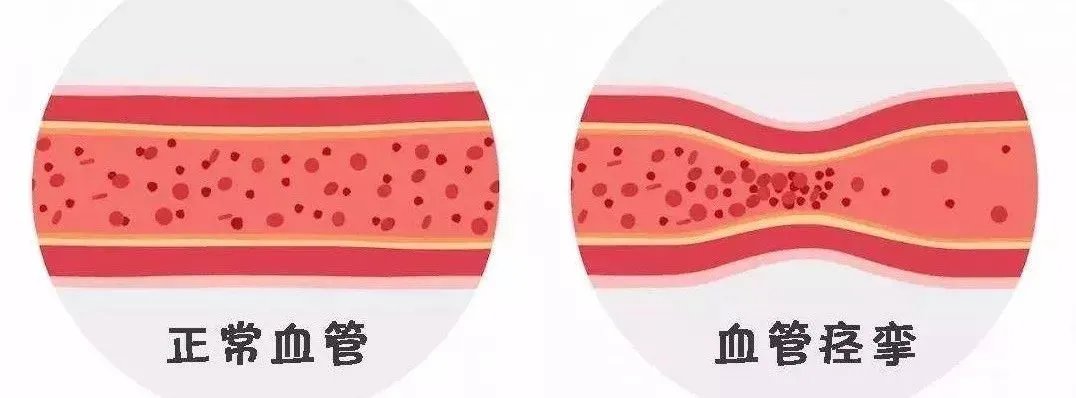 心肌缺血|“气死”是真的！72岁老太太吵架进医院，很多病都跟情绪有很大关系