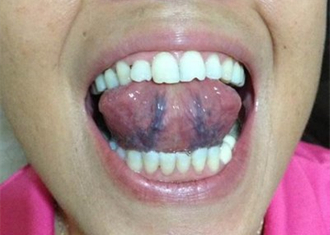 血瘀|病从血瘀生，十女有九淤！三个宝贝活血化瘀，美容养颜，值得一试