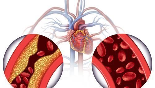 高血压|不同人群的高血压，降压药选择不同，千万别选错！