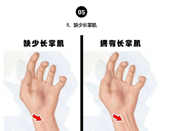 等位基因|罕见的身体特征只有少数人身上才拥有的10个罕见的特征