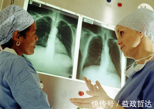 手术|肺结节切完，还会不会再长？劝你先做好这4件事