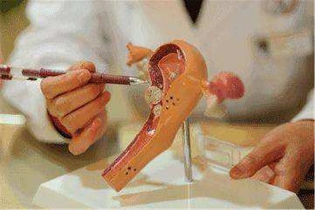 yd|坐月子期间不注重这几个细节,子宫容易“掉出来”,6招做好预防