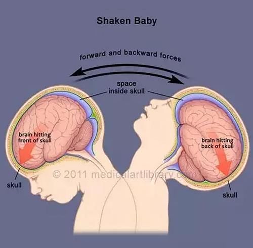 深度睡眠|6个月宝宝硬生生被哄成“脑瘫儿”，医生：奶奶好心，却害了孩子