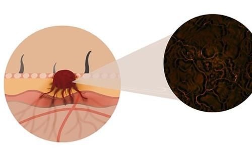 治疗方案|癌细胞明明已经扩散，为什么人依旧很精神，吃的也比较多？