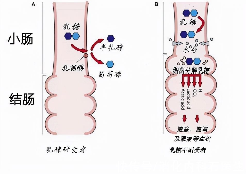 喝牛奶|不正确地喝牛奶可以导致骨质疏松,尤其是孩子,牛奶还敢喝吗?