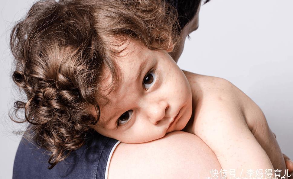 蚊子|嗡嗡嗡,你听你听,蚊子在狰狞的笑,它最喜欢小宝宝