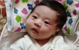 医生|“丑宝宝”被全家人嫌弃,医生却说孩子颜值很高,一个月后奇迹了