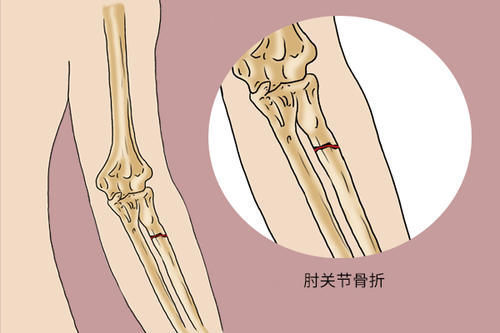 体重|女人体重过百就算胖？医生告诉你女性的标准体重，40岁后别太瘦