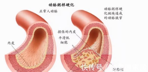 雌激素|都说50岁是女人的一道坎,年龄一到下肢无力全身疼痛就来了,咋办