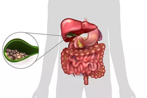 南京龍?bào)唇Y(jié)石醫(yī)院：得了結(jié)石有哪些忌口？