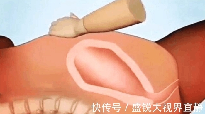 胎盘|生孩子后胎盘是怎样下来的, 看过这组动图你就明白了!