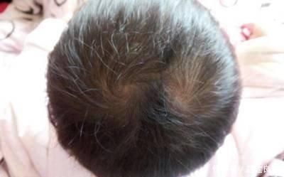 女孩|“双顶男孩找不到,双顶女孩没人要”,孩子头上的“旋”代表了啥