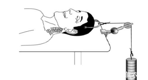 颈椎病|头晕头痛?脖子酸痛?手麻?颈椎病这个“流行”病要注意