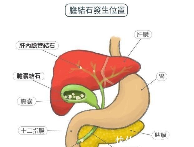 高脂血症|血脂高的人，眼睛可能有3个症状，若没有，说明血脂控制的还不错