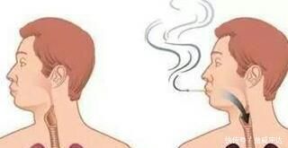 概率|100个吸烟者中，会有多少人患上肺癌呢？现在戒烟还来得及吗？