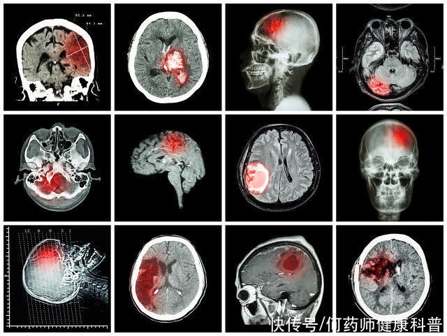 天麻素制剂|天麻素,增加心脑供血、镇痛、保护神经、辅助降压、改善焦虑失眠