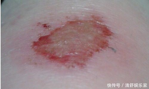 當身體出現以下五種癥狀,多半是長壽的象征,別以為是生病!