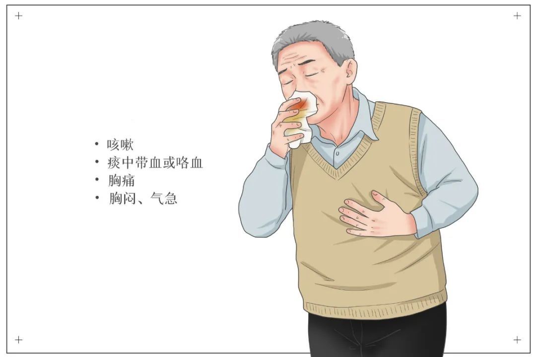 预警|【健康科普】癌症到来的这几个预警信号，千万要注意！
