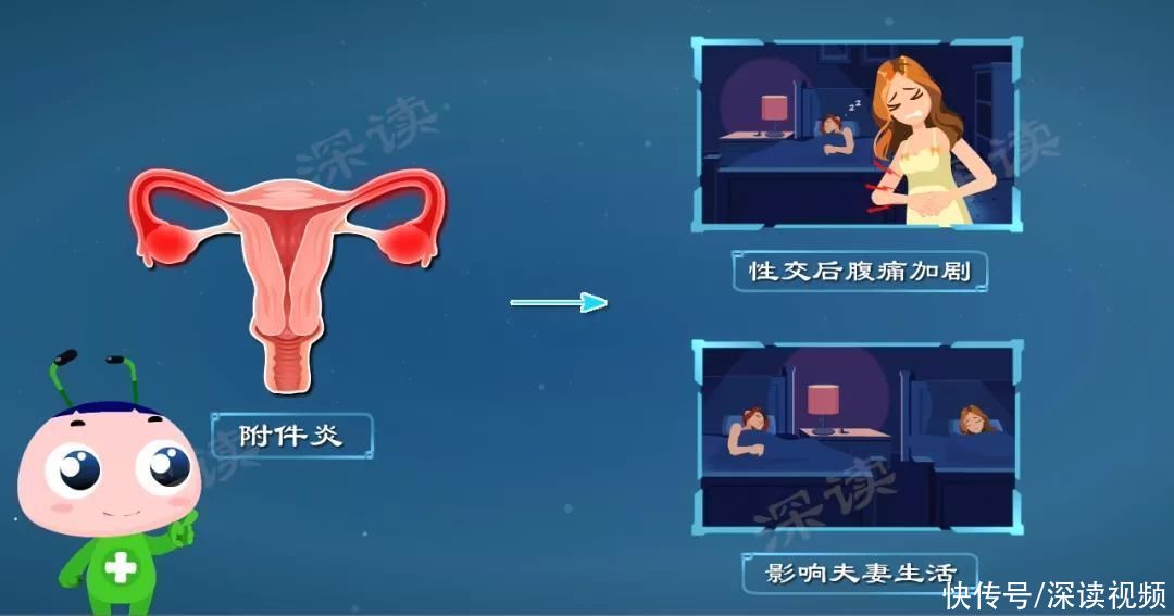 小姐姐|下腹持续隐痛？白带增多有异味？导致不孕的附件炎到底是啥样？