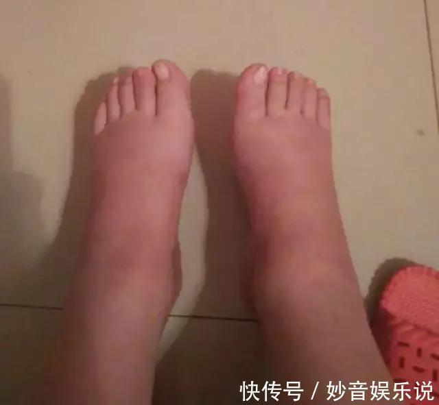 缝针|为什么现在的女孩子都那么害怕生孩子？