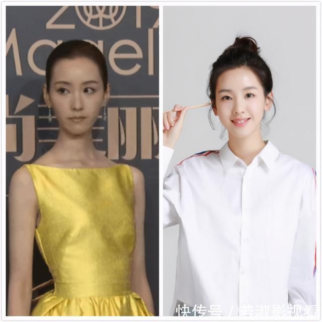 下颌骨|判断自己是不是“耐老脸”?一般看4个面部承重墙,你中了几个?