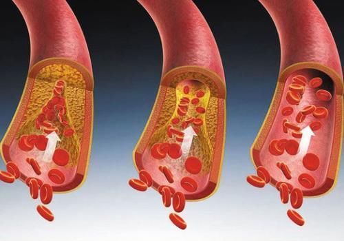 骑自行车|糖尿病不能喝牛奶?提醒:远离这3种食物,血糖或能降回正常值