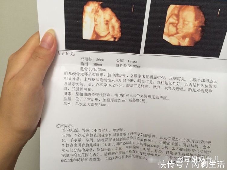 畸形|四维彩超能够预防胎儿畸形吗?四维彩超真正有6个作用,别搞错