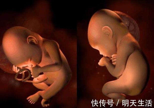 就医|胎儿总在夜间胎动，可不是胎儿太淘气，背后原因孕妇别大意