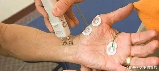 手部麻木的7种常见病因、如何鉴别及治疗