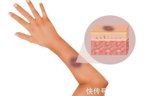 脾气虚|十人九脾虚脾虚命薄,老祖宗留下的健脾妙方,补虚养脾全身轻松