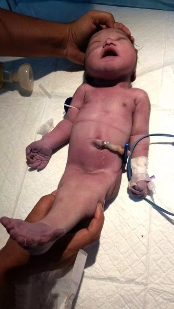 孕妇|孕妇医院产子,孩子出生后,在场医生护士无法淡定