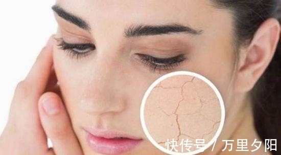 皮脂 痘博士 五大类肤质特性,让你远离护肤误区更懂保养自己皮肤