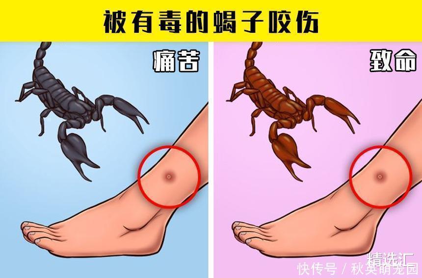 毒蘑菇|在紧急情况下，或许可以拯救生命的7个小技巧