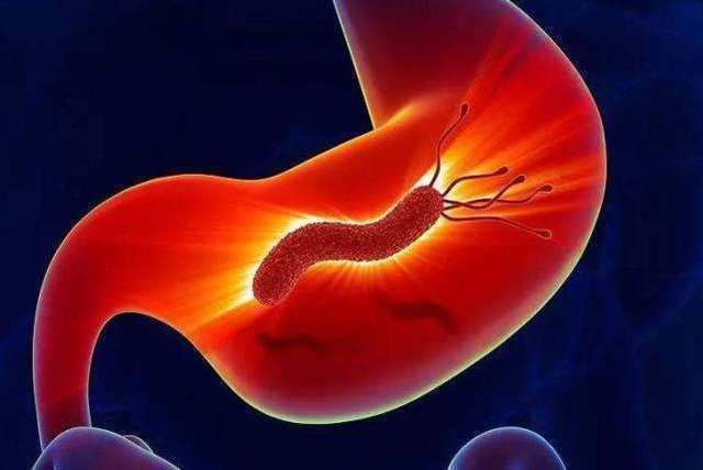 十二指肠溃疡|胃病“最怕”的6种食物坚持1月,击退幽门杆菌,胃胀胃痛说再见