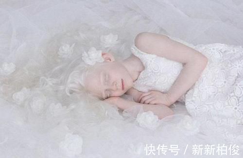 元气满满|“妈妈,我怕光”,姐妹俩出生全身雪白,网友:父母太不负责任