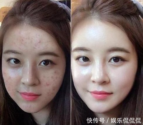 精华液|精华液早晚都得擦一问美容师,好多人弄错,皮肤变差还浪费钱!