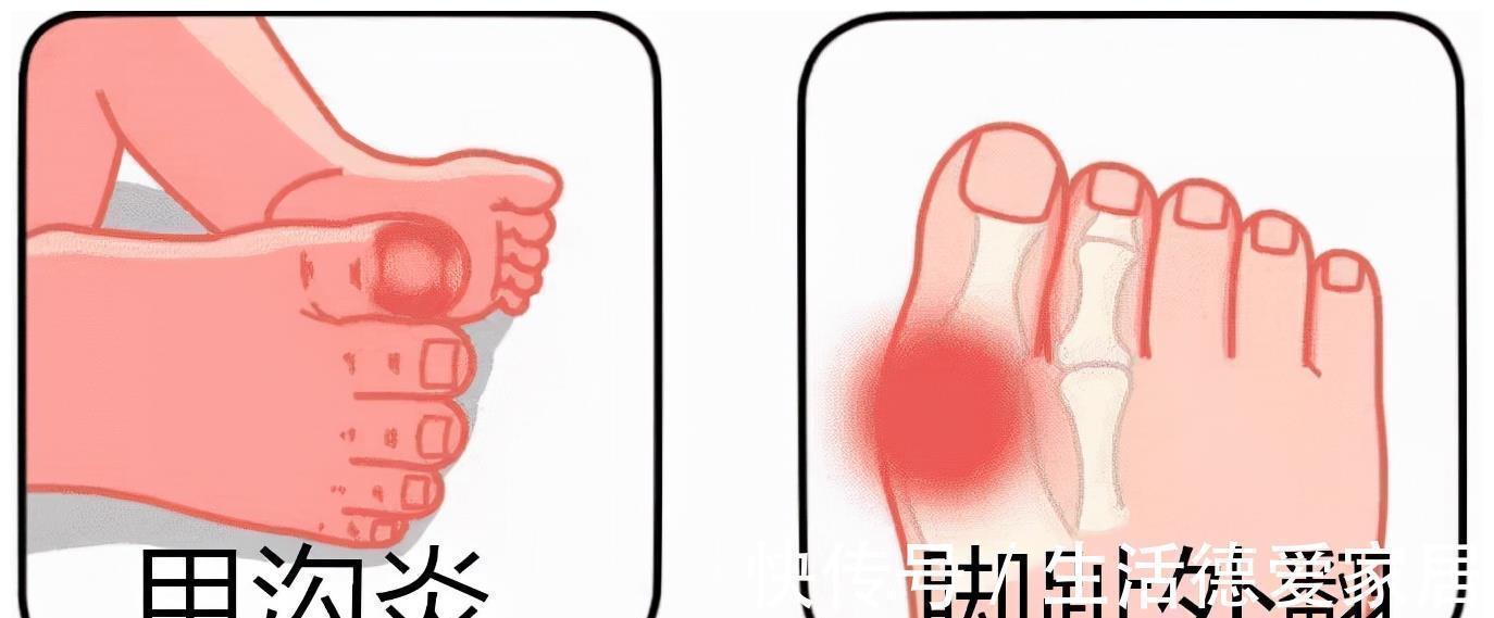 鞋头|小鞋子,大学问,如何给宝宝挑选一双合适的鞋子?