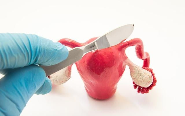 优质蛋白|子宫切除之后就不能算女人了？当然不是，注意这4个护理重点