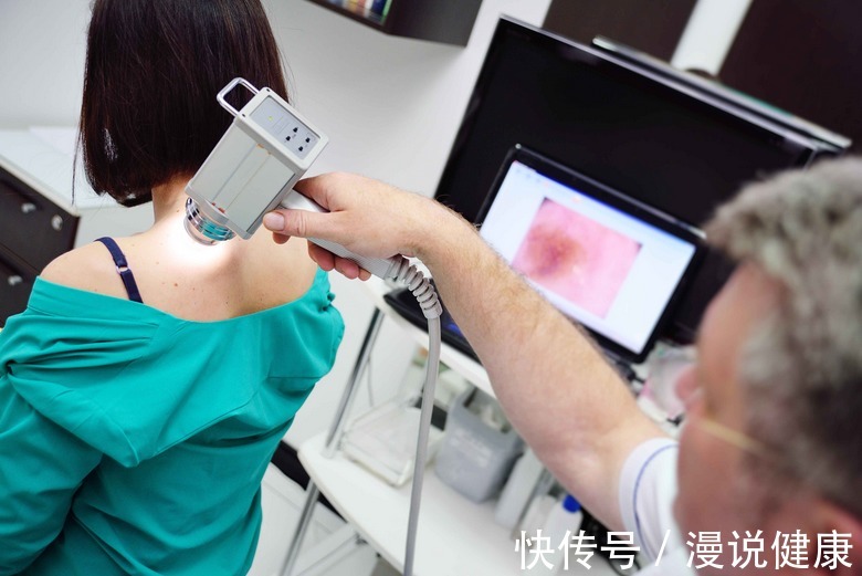 黑痣|身上莫名长出痣,别满不在乎,若是这5种,当心是黑色素瘤