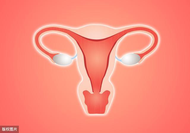 hpv|身体有4个迹象，多半宫颈癌已上身，3个习惯再爱做，也要戒掉